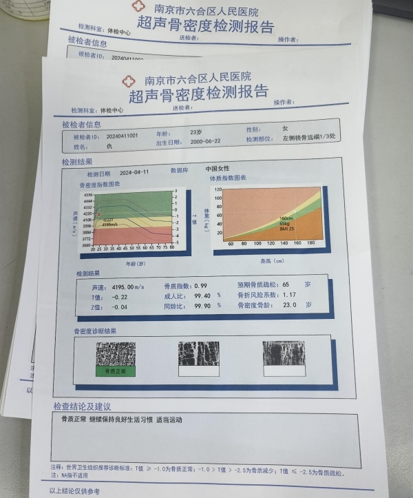 一文了解超聲骨密度儀的基本原理、技術(shù)特點及應(yīng)用領(lǐng)域